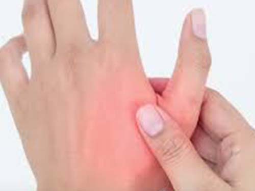Thumb Arthritis Kenya