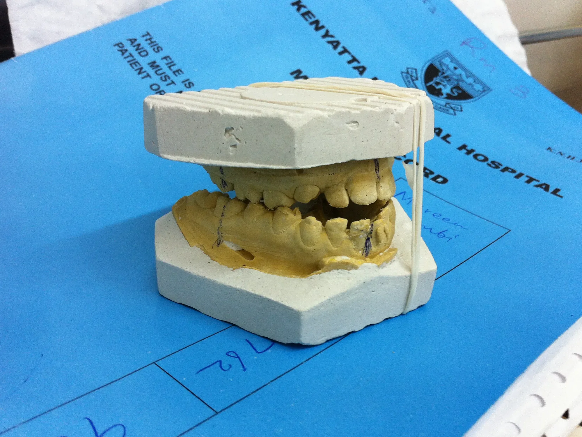 Maxillofacial input needed uai