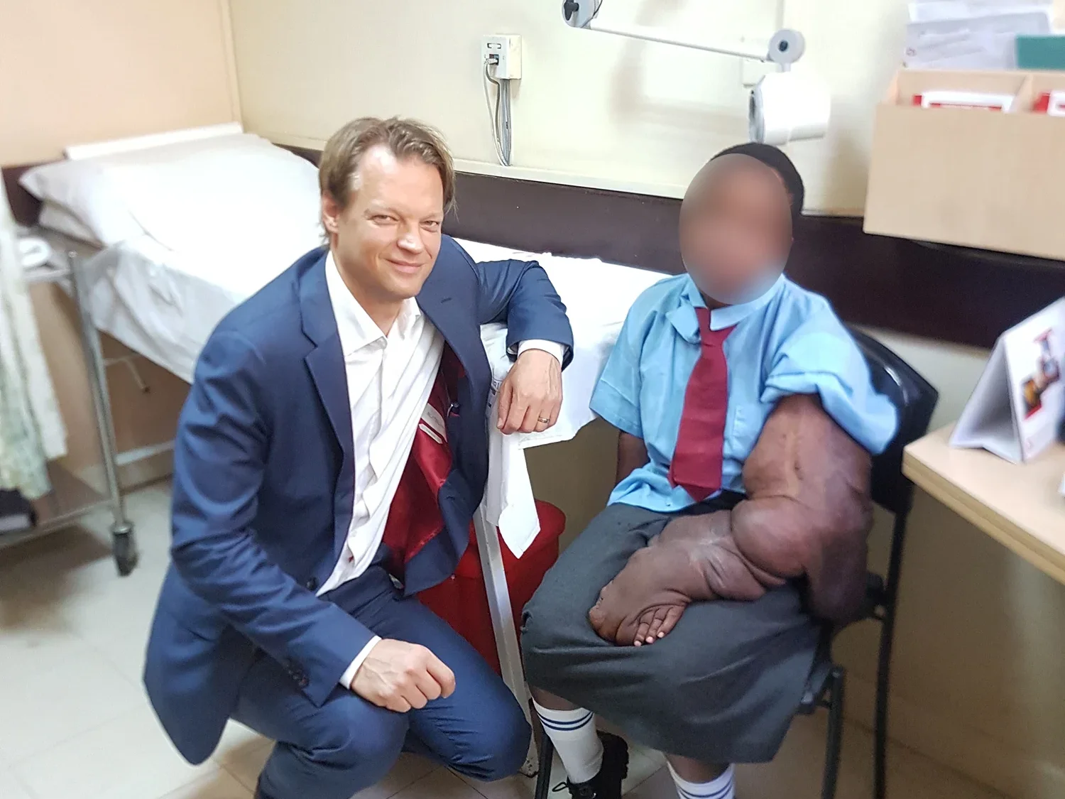 Plexiform Neurofibromatosis dr stasch1 uai