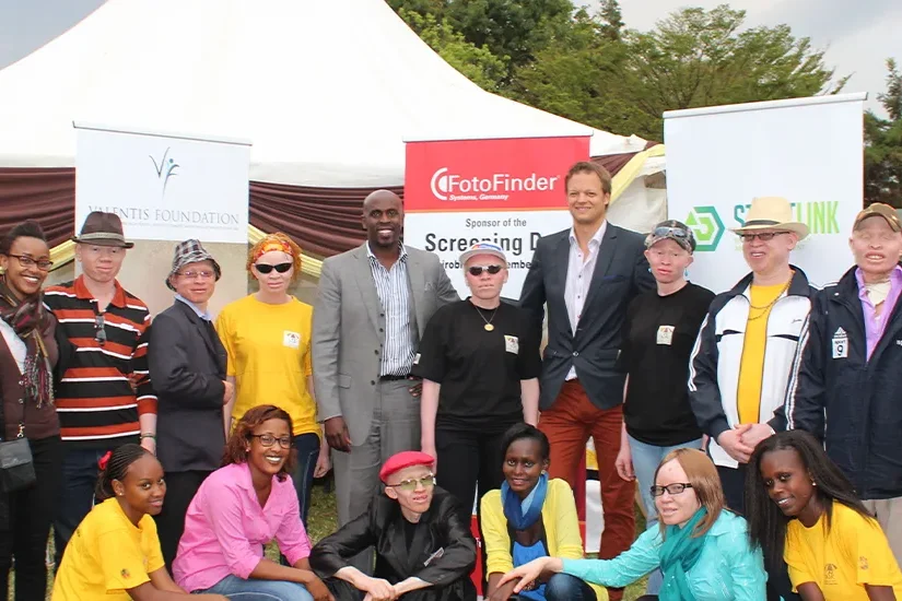 albinism project dr stasch pro bono