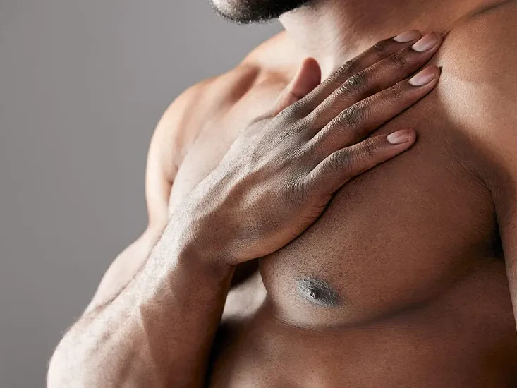 Gynaecomastia 3 before after gynaecomastia gallery uai