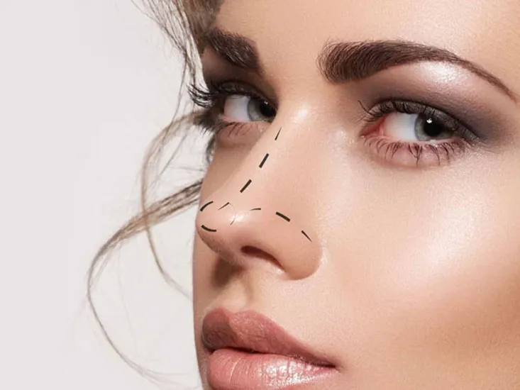 Liquid Rhinoplasty 2 before after liquid rhinoplasty gallery uai