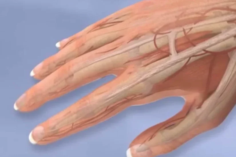hand or finger reconstruction uai