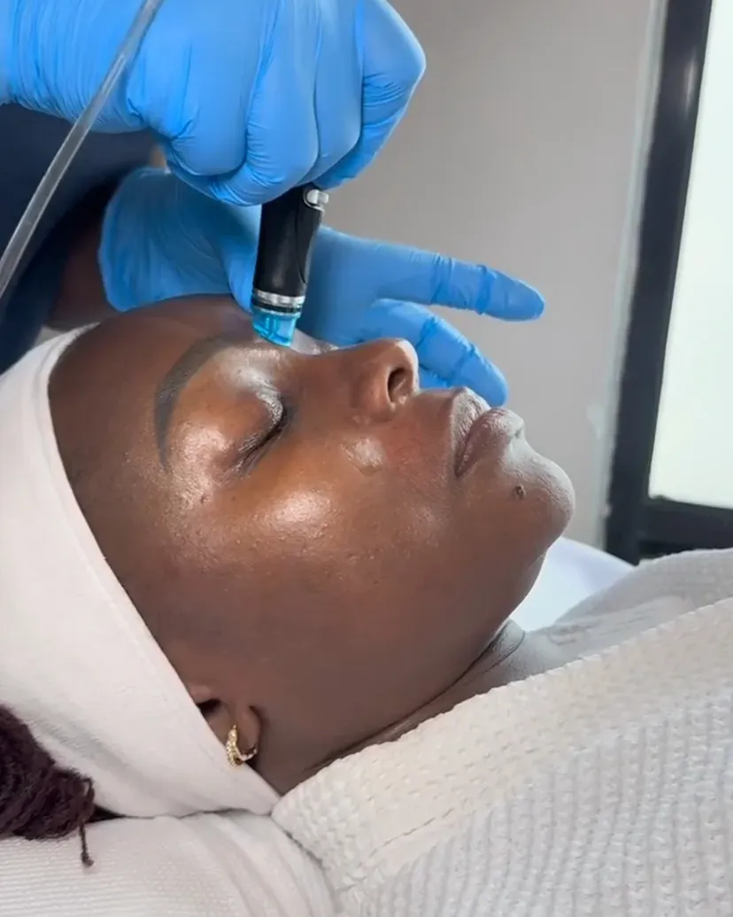 hydrafacial-nairobi 7 hydrafacial nairobi uai