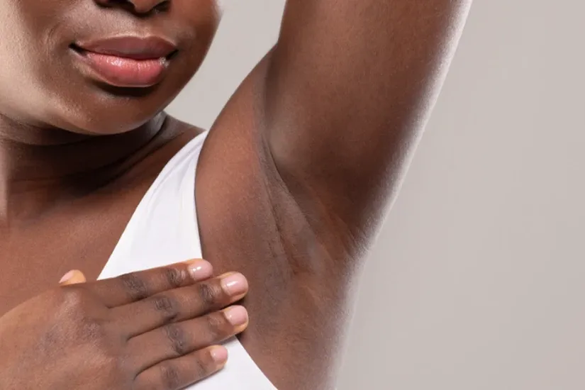 Hyperhidrosis (Excessive Sweating) 1 hyperhidrosis excessive sweating uai