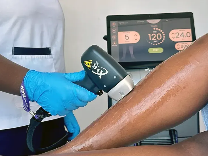 laser hair removal uai