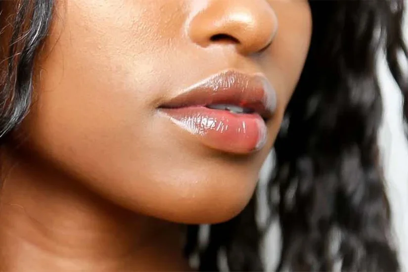 lip correction surgery in kenya