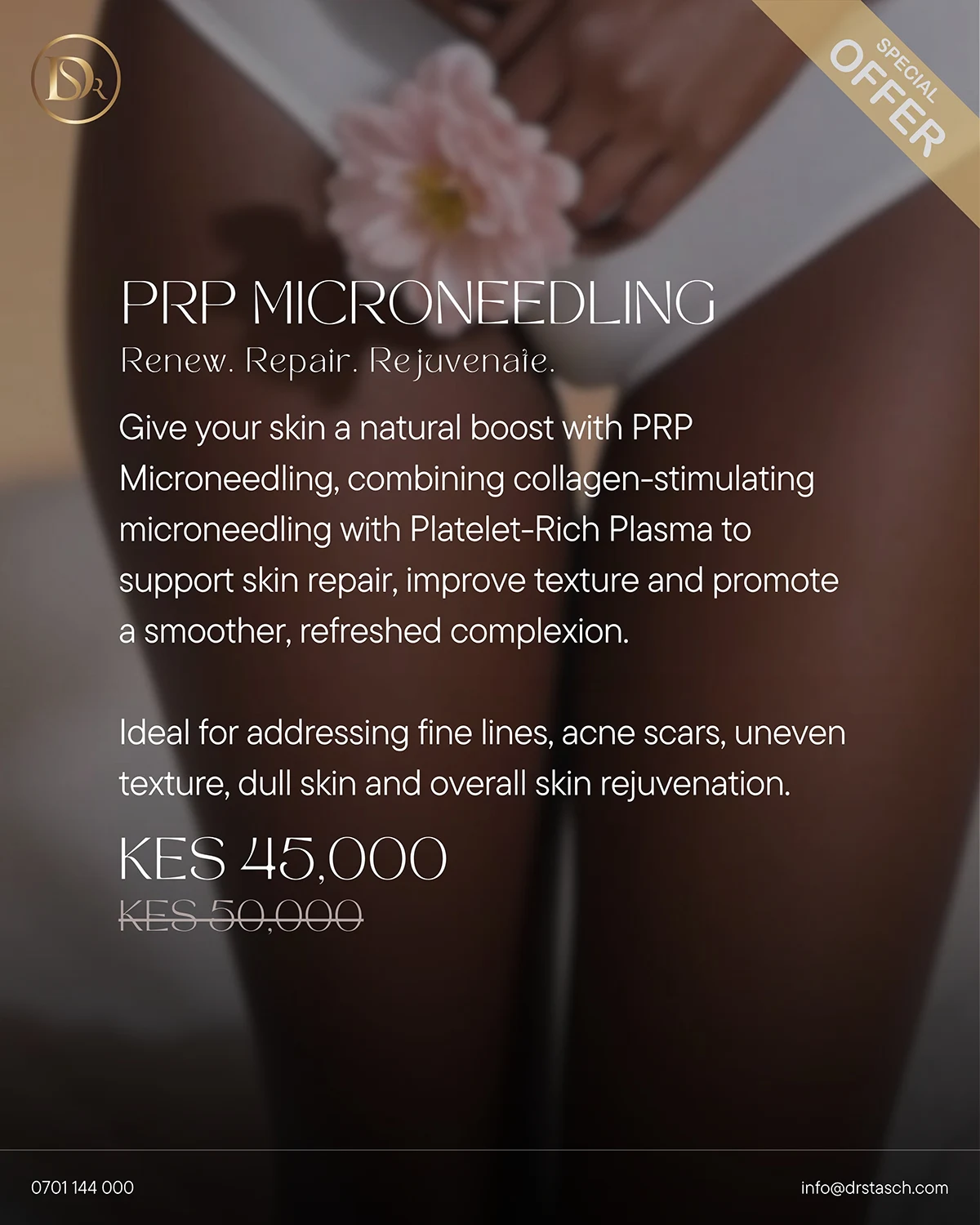 prp microneedling aug26 offer