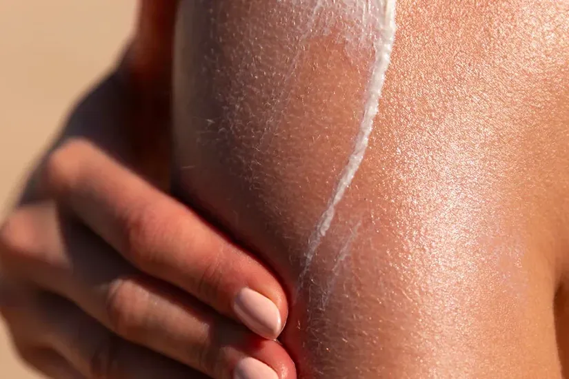 Sun Damage, Dark Spots & Skin Cancer Risk in Kenya 3 sun damage dark spots and skin cancer risk in kenya uai